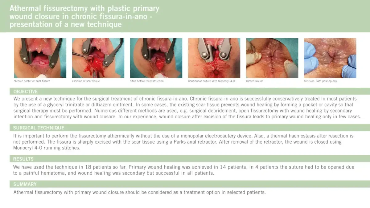 Athermal fissurectomy