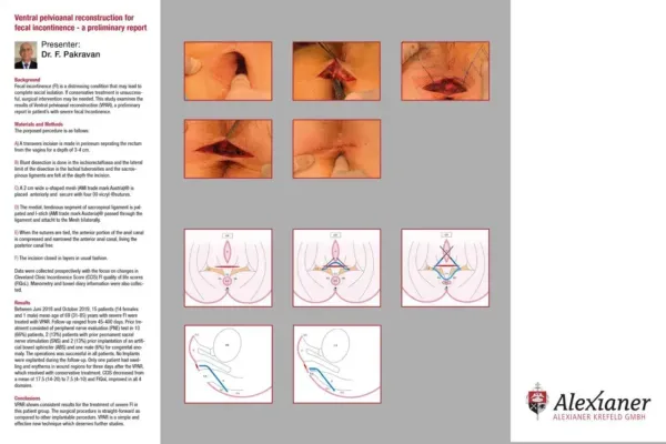 Poster: Ventral Pelvioanal Reconstruction, ASCRS Boston