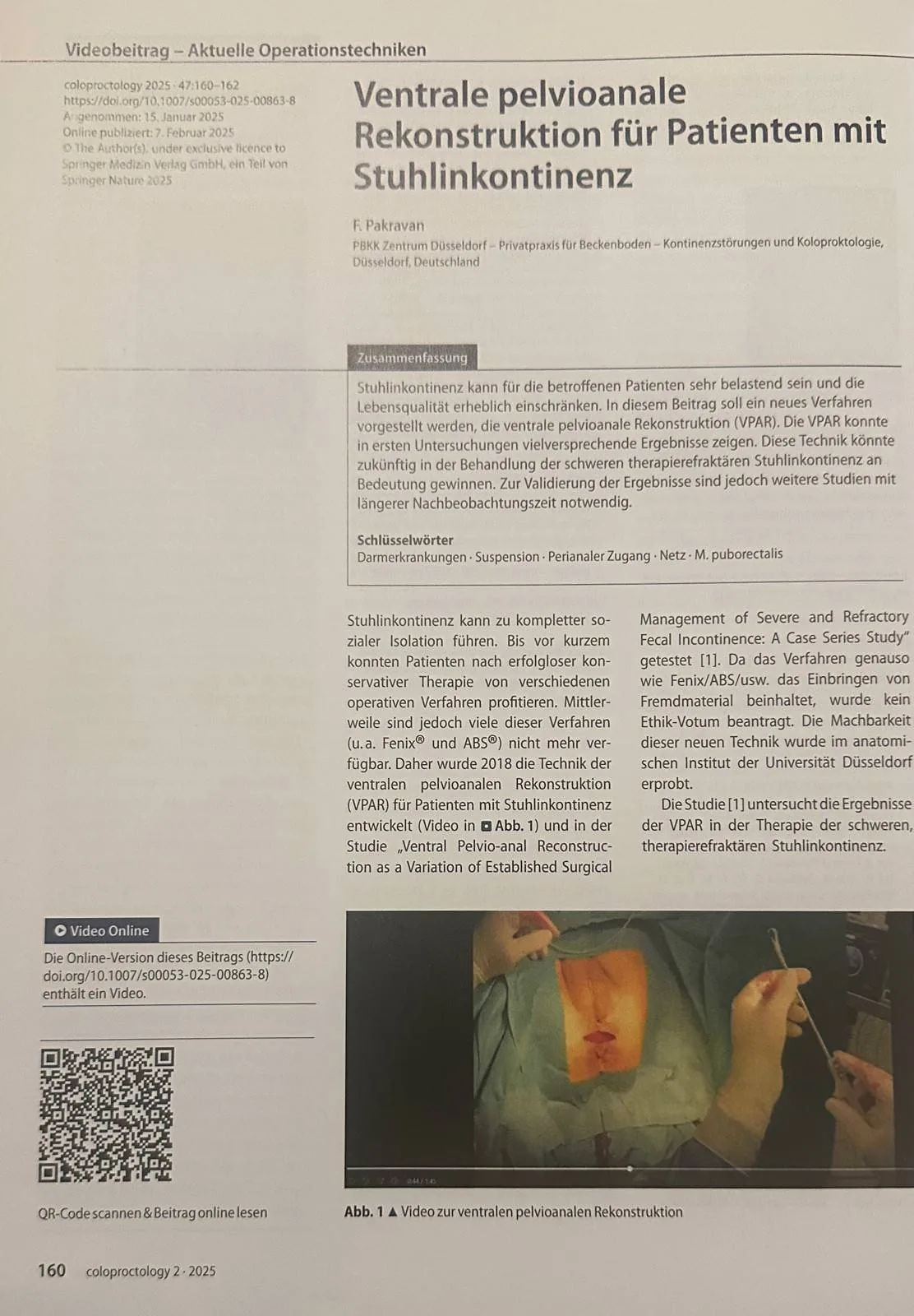 Veröffentlichung in coloproctology zur ventralen pelvioanalen Rekonstruktion, April 2025